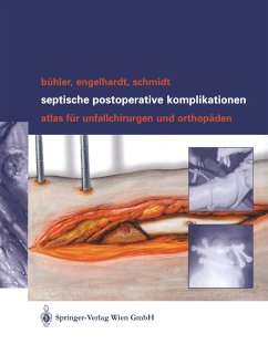 Septische postoperative Komplikationen - Bühler, Matthias;Engelhardt, Martin;Schmidt, Hergo G.K.