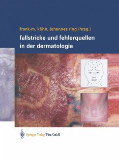 Fallstricke und Fehlerquellen in der Dermatologie - Köhn, Frank-Michael / Ring, Johannes (Hgg.)