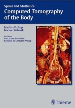 Cover Computed Tomography of the Body