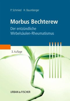 Morbus Bechterew - Schmied, Paul;Baumberger, Heinz