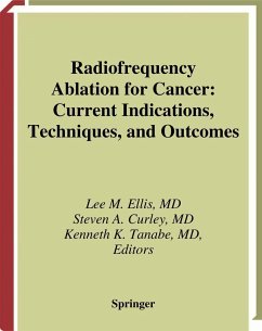 Radiofrequency Ablation for Cancer - Ellis, Lee M. / Curley, Steven A. / Tanabe, Kenneth K. (eds.)