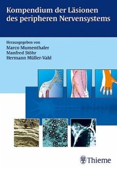 Kompendium der Läsionen des peripheren Nervensystems - Gamper, Urs / Millesi, Hanno / Schröder, Michael