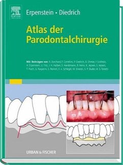 Atlas der Parodontalchirurgie - Erpenstein, Heinz; Diedrich, Peter