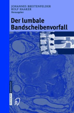 Der lumbale Bandscheibenvorfall - Breitenfelder, Johannes / Haaker, Rolf (Hgg.)