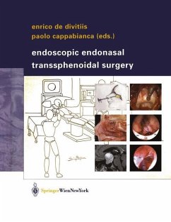 Endoscopic Endonasal Transsphenoidal Surgery - Divitiis, Enrico de / Cappabianca, Paolo (eds.)