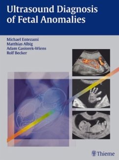 Ultrasound Diagnosis of Fetal Anomalies - Entezami, Michael / Albig, Matthias / Gasiorek-Wiens, Adam