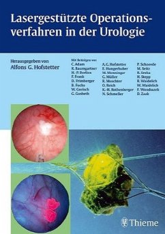 Lasergestützte Operationsverfahren in der Urologie - Adam, Christoph / Baumgartner, Reinhold / Berlien, Hans P