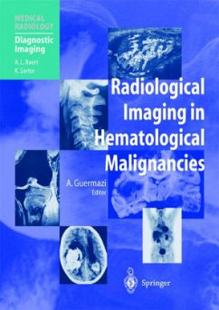 Cover Radiological Imaging in Hematological Malignancies