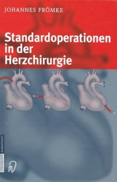 Standardoperationen in der Herzchirurgie - Frömke, Johannes