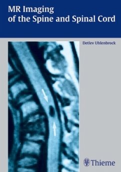 MR Imaging of the Spine and Spinal Cord - Uhlenbrock, Detlev