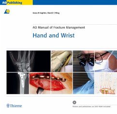 AO Manual of Fracture Management Hand and Wrist, with CD-ROM - Jupiter, Jesse B.