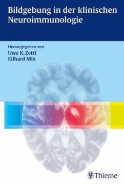 Bildgebung in der klinischen Neuroimmunologie - Zettl, Uwe Kl. / Klaus Zettl / Mix, Eilhard (Hgg.)