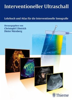Interventioneller Ultraschall - Dietrich, Christoph Frank / Nürnberg, Dieter / Schölmerich, Jürgen
