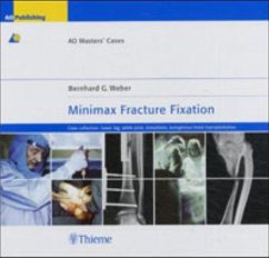 Minimax Fracture Fixation - Weber, Bernhard G.