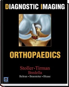 Diagnostic Imaging, Orthopaedics - Stoller, David W.; Tirman, Phillip F. J.; Bredella, Miriam A.