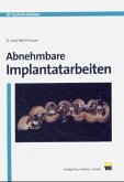 Abnehmbare Implantatarbeiten Abnehmbare Implantatarbeiten