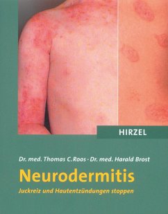 Neurodermitis - Roos, Thomas C.;Brost, Harald