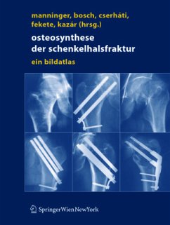 Osteosynthese der Schenkelhalsfraktur - Manninger, Jenö / Bosch, Ulrich / Cserháti, Péter / Fekete, Karoly / Kazar, György (Hgg.)