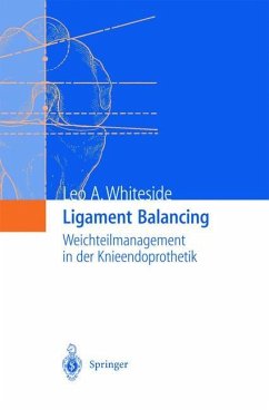 Ligament Balancing - Whiteside, Leo A.