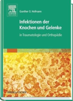 Infektionen der Knochen und Gelenke in Traumatologie und Orthopädie - Hofmann, Gunther O.