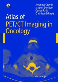 Atlas of PET/CT Imaging in Oncology, w. CD-ROM - Czernin, Johannes / Dahlbom, M. / Ratib, O. / Schiepers, Christiaan