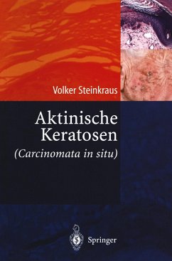 Aktinische Keratosen (Carcinomata in situ) - Steinkraus, Volker