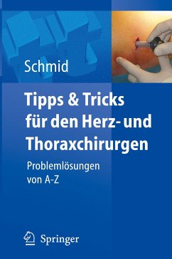 Tipps und Tricks für den Herz- und Thoraxchirurgen - Schmid, Christof