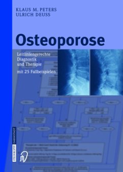 Osteoporose - Peters, Klaus M.;Deuß, Ulrich