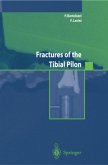 Fractures of the Tibial Pilon