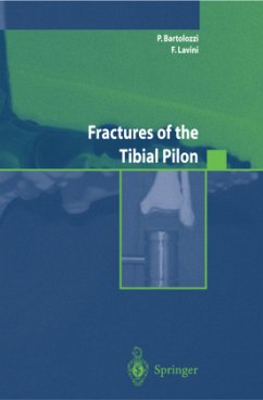 Fractures of the Tibial Pilon - Bartolozzi, P.;Lavini, F.