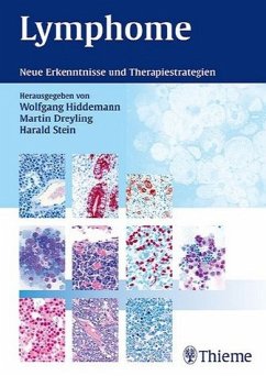 Lymphome - Hiddemann, Wolfgang / Dreyling, Martin / Stein, Harald