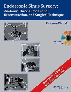 Endoscopic Sinus Surgery - Wormald, Peter-John