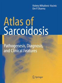 Atlas of Sarcoidosis - Mihailovic-Vucinic, Violeta;Sharma, O. P.