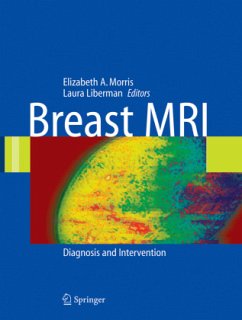 Breast MRI - Morris, Elizabeth / Liberman, Laura (eds.)
