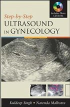 Step by Step Ultrasound in Gynecology - Singh, Kuldeep / Malhotra, Narendra