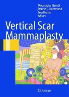 Vertical Scar Mammaplasty - Hamdi, Moustapha / Hammond, Dennis C. / Nahai, Foad (eds.)