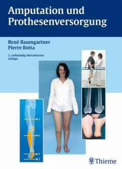 Amputation und Prothesenversorgung - Baumgartner, Rene;Botta, Pierre;Bellmann, Dieter