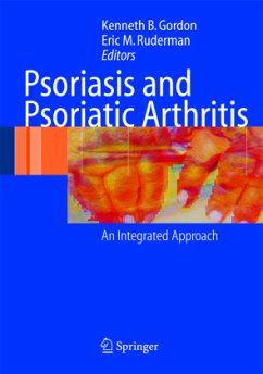 Psoriasis and Psoriatic Arthritis - Gordon, Kenneth B. / Ruderman, Eric M. (eds.)