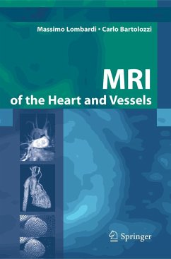 MRI of the Heart and Vessels - Lombardi, Massimo; Bartolozzi, Carlo