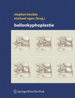 Ballonkyphoplastie - Becker, Stephan / Ogon, Michael (Hgg.)
