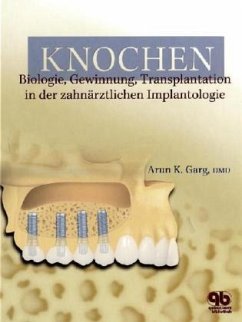 Knochen - Garg, Arun K.