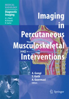Imaging in Percutaneous Musculoskeletal Interventions - Gangi, Afshin / Guth, Stephane / Guermazi, Ali