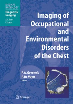 Imaging of Occupational and Environmental Disorders of the Chest - Gevenois, Pierre Alain / Vuyst, Paul de (eds.)