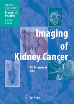 Imaging of Kidney Cancer - Guermazi, Ali (ed.)