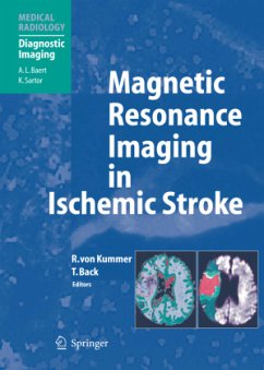 Magnetic Resonance Imaging in Ischemic Stroke - Kummer, Rüdiger von / Back, Tobias (eds.)