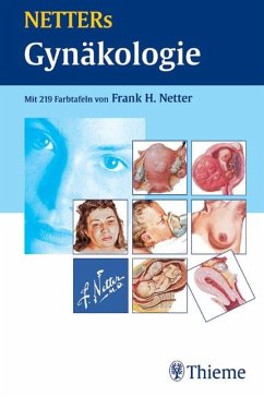 NETTERs Gynäkologie - Netter, Frank H.