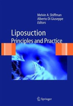 Liposuction - Shiffman, Melvin A. / Giuseppe, Alberto Di (eds.)