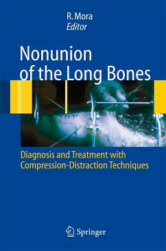 Cover Nonunion of the Long Bones