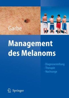 Management des malignen Melanoms - Garbe, Claus (Hrsg.)