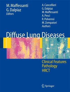 Diffuse Lung Diseases - Maffessanti, Mario / Dalpiaz, Giorgia (eds.)